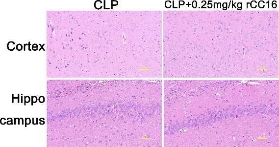 Effect of rCC16 treatment on the pathological changes in CLP rats.jpg